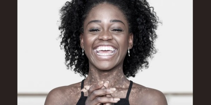 Michaela DePrince